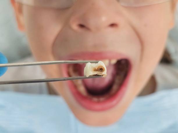 Professional Emergency Dental Service in SD